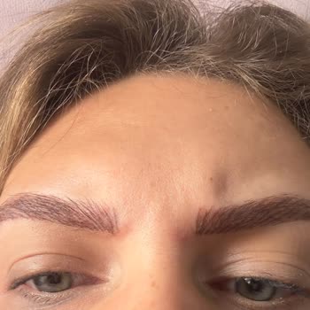 Kaş İşleminde Hatalı Uygulama Ve Müşteri Memnuniyetsizliği