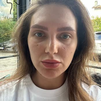 Kaş İşleminde Hatalı Uygulama Ve Müşteri Memnuniyetsizliği