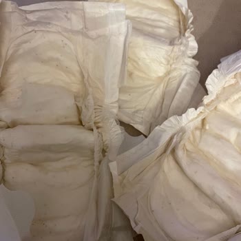 Bebeğimin Sağlığı İçin Endişeliyim: Siyah Noktalı Bezler