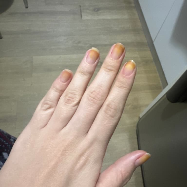 Flormar Oje Tırnakta Kalıcı Leke Bıraktı