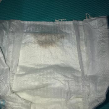 Bebek Bezinde Gizemli Siyah Madde