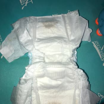 Bebek Bezinde Gizemli Siyah Madde