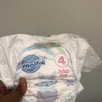 Bebek Bezinde Gizemli Siyah Madde