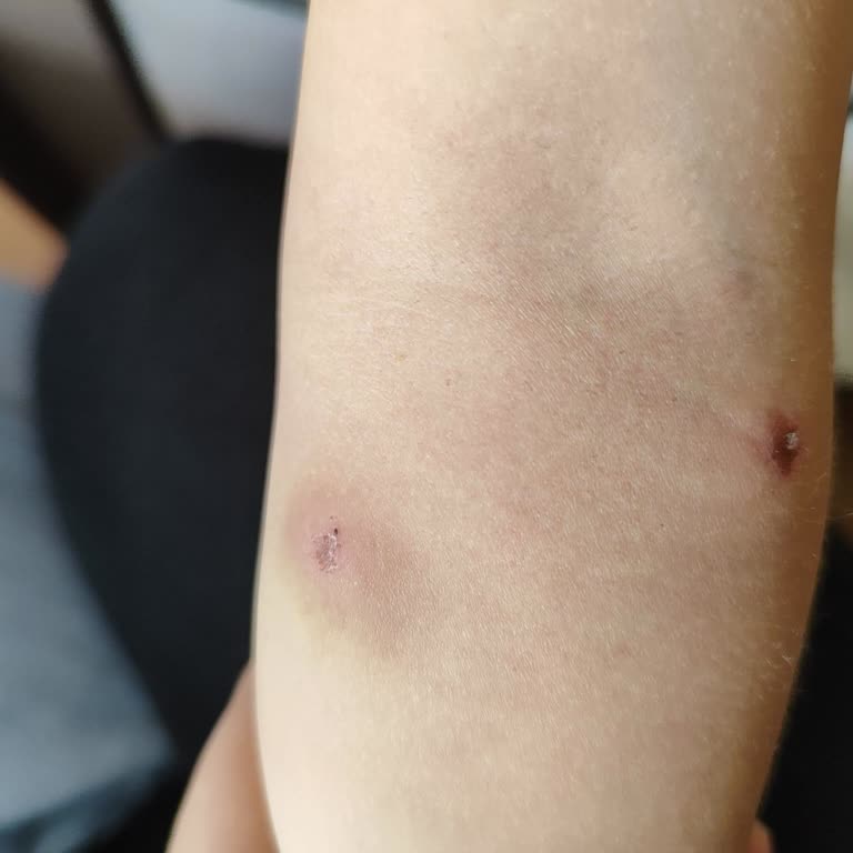 Çekmeköy Park Of İstanbul'da Güvenlik Sorunu!