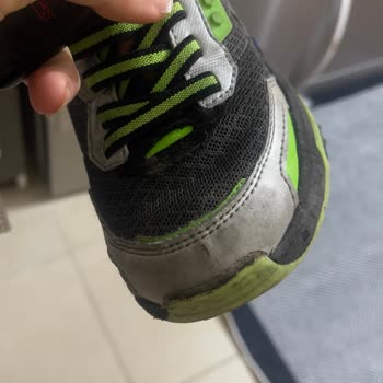 Kısa Sürede Deforme Olan Skechers Ayakkabı Hayal Kırıklığı Yarattı