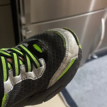 Kısa Sürede Deforme Olan Skechers Ayakkabı Hayal Kırıklığı Yarattı
