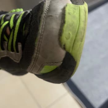 Kısa Sürede Deforme Olan Skechers Ayakkabı Hayal Kırıklığı Yarattı