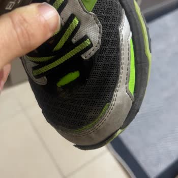 Kısa Sürede Deforme Olan Skechers Ayakkabı Hayal Kırıklığı Yarattı