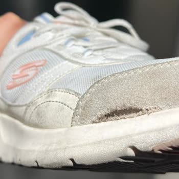 Skechers Ayakkabının Dayanıklılığı Hayal Kırıklığı Yarattı