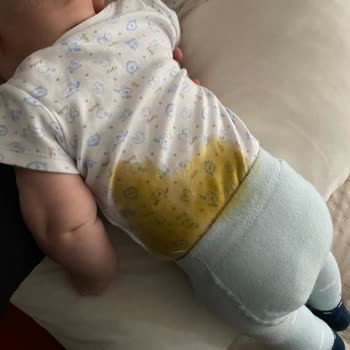 Prima Bebek Bezi Sızıntı Sorunu: Hayal Kırıklığı