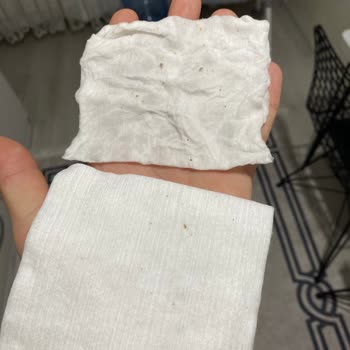 Bebek Temizleme Pamuğunda Hijyen Sorunu