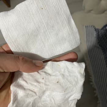 Bebek Temizleme Pamuğunda Hijyen Sorunu