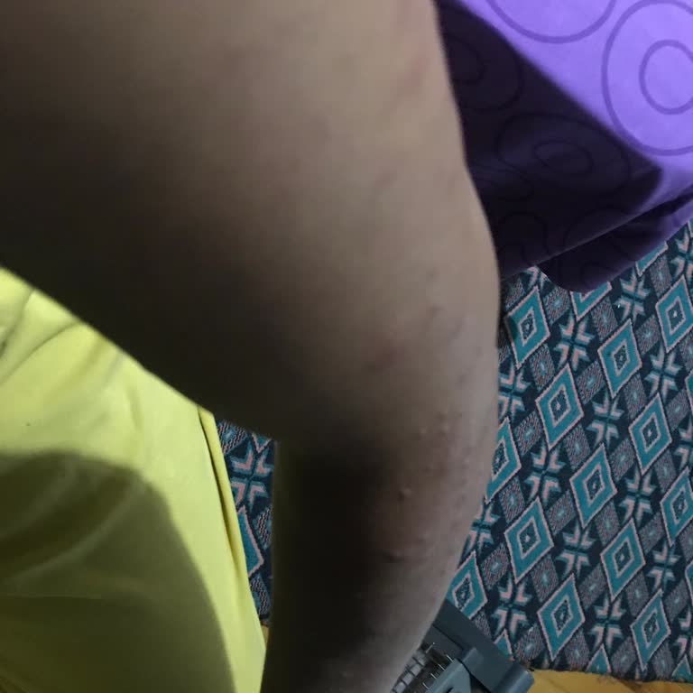 Bianca Plus Apart Tahta Kurusu Ve Gürültü Kabusu