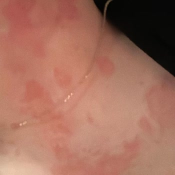 Tex Hijyen Köpük El Sabunu, Cildimde Tahribata Yol Açtı!