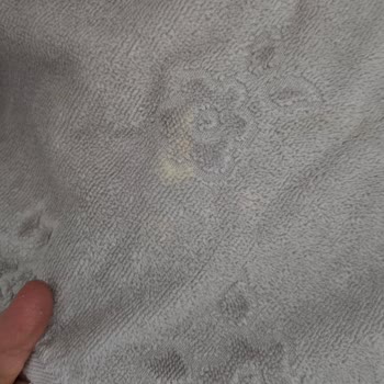 Özdilek Havlularında Gizemli Lekeler