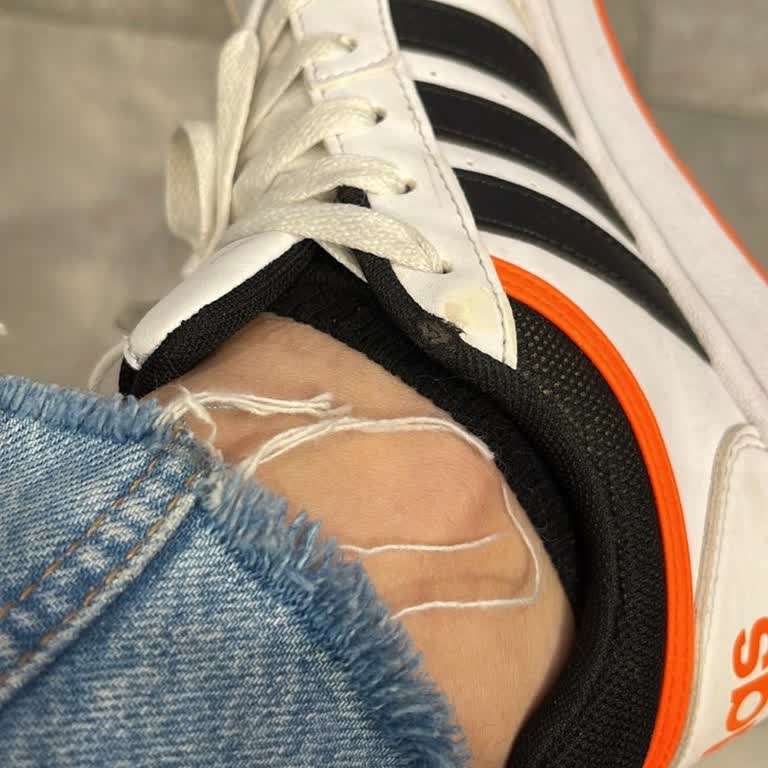 Adidas Ayakkabıda İlk Ayda Yırtılma Sorunu