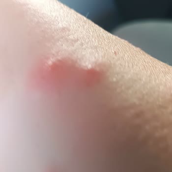 Kötü Kokulu Oda Ve Hijyen Sorunlarıyla Hayal Kırıklığı