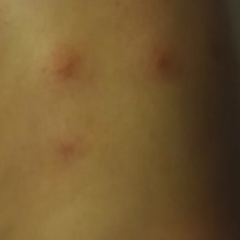 Kötü Kokulu Oda Ve Hijyen Sorunlarıyla Hayal Kırıklığı