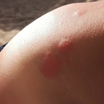 Kötü Kokulu Oda Ve Hijyen Sorunlarıyla Hayal Kırıklığı