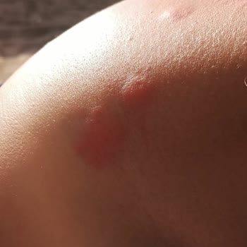 Kötü Kokulu Oda Ve Hijyen Sorunlarıyla Hayal Kırıklığı