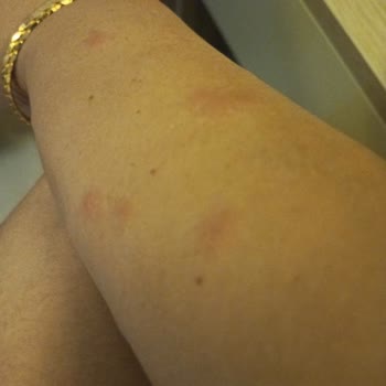 Kötü Kokulu Oda Ve Hijyen Sorunlarıyla Hayal Kırıklığı