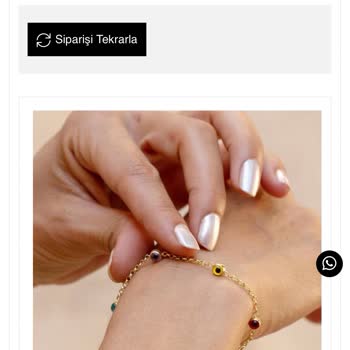 Kalitesiz Bileklik Ve Sorumsuz Müşteri Hizmeti