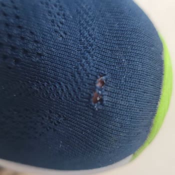 Asics Koşu Ayakkabısında Erken Yıpranma Sorunu