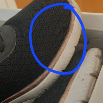 Ayakkabı Dünyası'nda Hayal Kırıklığı: Skechers Ayakkabıda Erken Yırtılma