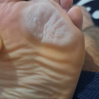 Nike Ayakkabıda Beklenmedik Renk Değişimi Ve Nemlenme Sorunu