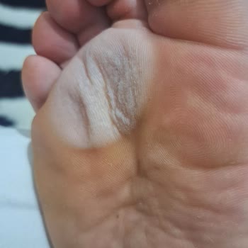 Nike Ayakkabıda Beklenmedik Renk Değişimi Ve Nemlenme Sorunu