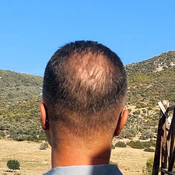 Eki aç