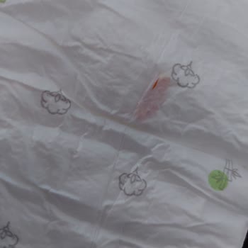 Bebek Bezi İçindeki Tehlikeli Yabancı Madde