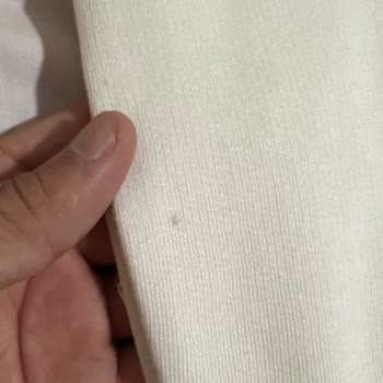 Zara'dan Lekeli Ürün Ve Yetersiz Çözüm