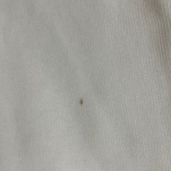 Zara'dan Lekeli Ürün Ve Yetersiz Çözüm