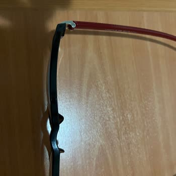 Atasun'da Hayal Kırıklığı: İlgisiz Hizmet Ve Defolu Gözlük Camı