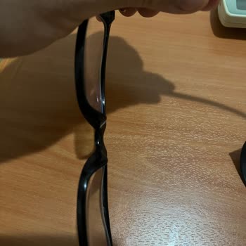 Atasun'da Hayal Kırıklığı: İlgisiz Hizmet Ve Defolu Gözlük Camı