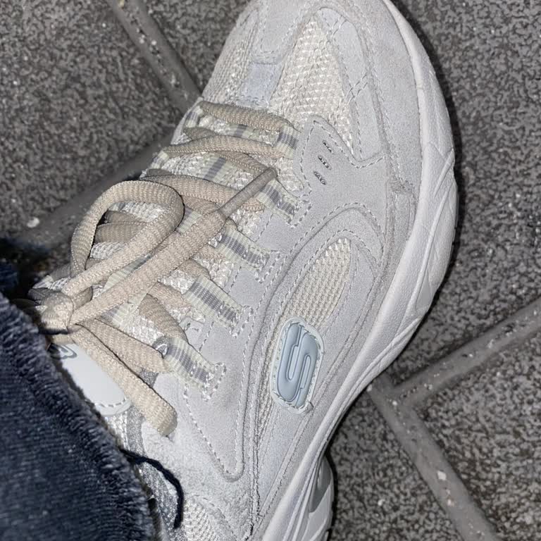 Skechers Ayakkabının Renk Değişimi Hayal Kırıklığı Yarattı