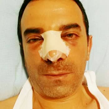 Yanlış Ameliyat Ve Kalıcı Hasar