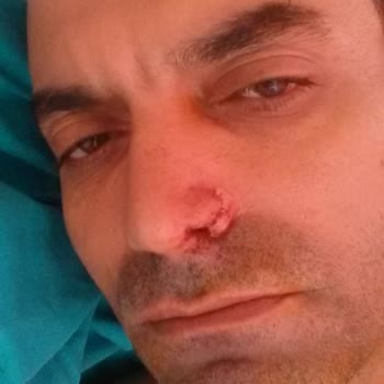 Yanlış Ameliyat Ve Kalıcı Hasar