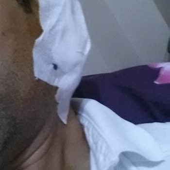 Yanlış Ameliyat Ve Kalıcı Hasar