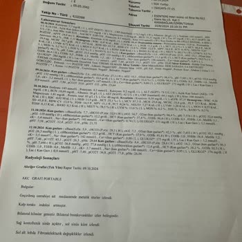 Hizmet İadesi Talebime Duyarsızlık