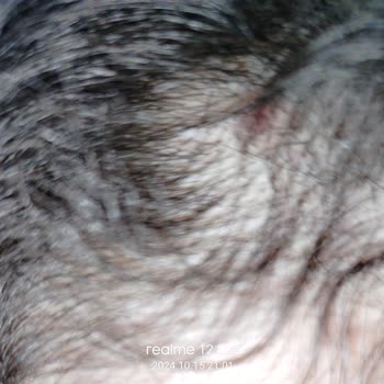 Urban Care Şampuan: Saç Dökülmesi Ve Cilt Problemleri