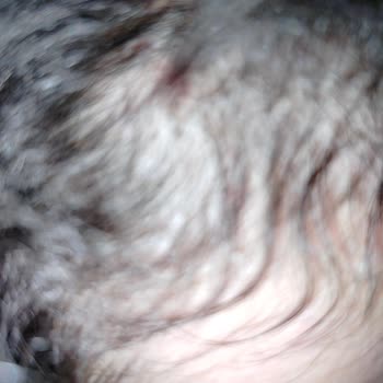 Urban Care Şampuan: Saç Dökülmesi Ve Cilt Problemleri