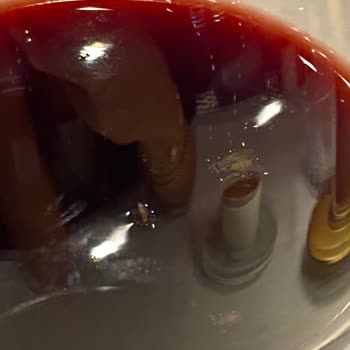 İlgisizlik Ve Hijyen Sorunu