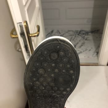 Pelinin Ayakkabılarında Sürekli Sorun Yaşıyorum