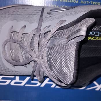 Skechers Ayakkabılarımda Erken Deformasyon