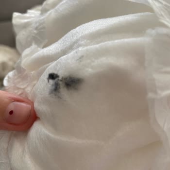 Sleepy Bebek Bezinde Hijyen Sorunu: Ürün Kalitesi Hayal Kırıklığına Uğrattı