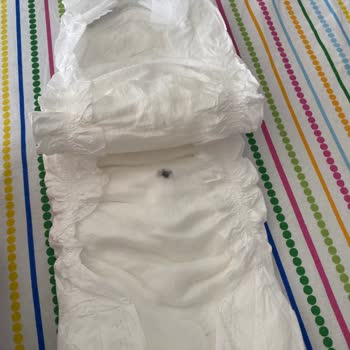 Sleepy Bebek Bezinde Hijyen Sorunu: Ürün Kalitesi Hayal Kırıklığına Uğrattı