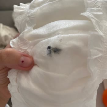 Sleepy Bebek Bezinde Hijyen Sorunu: Ürün Kalitesi Hayal Kırıklığına Uğrattı