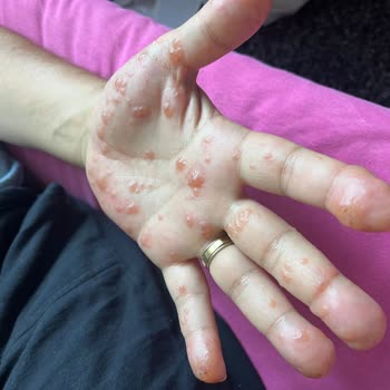 Egepol Hastanesi Yanlış Tedavi Ve İlgisiz Doktor Deneyimi